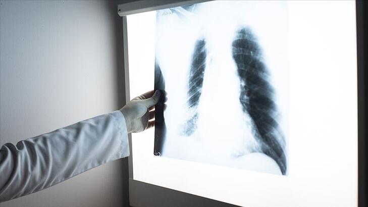 Üniversitemiz 20 Kasım Dünya KOAH Günü Nedeniyle Bilgilendirme Mesajı Yayımladı